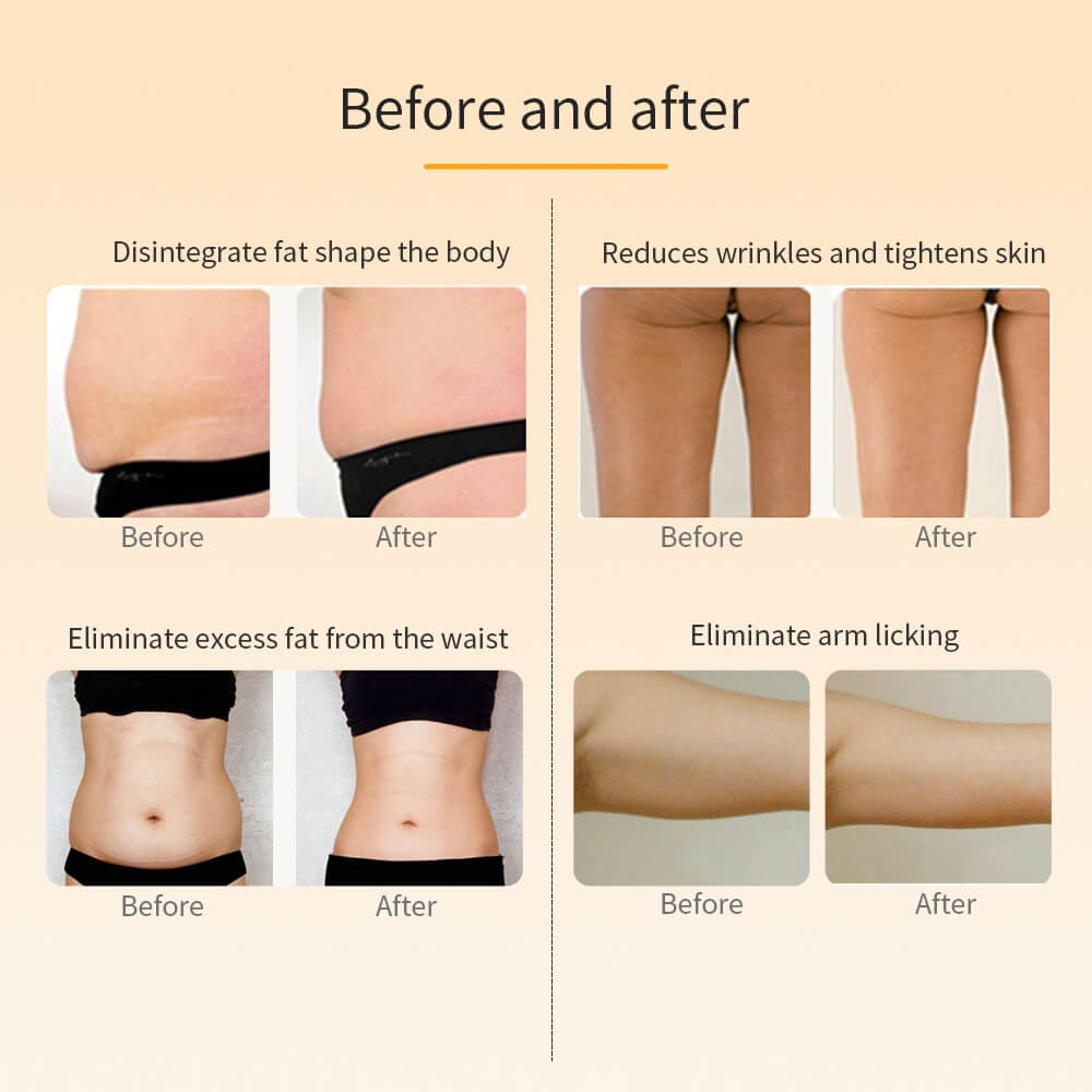 GraceAllure - RF Slimming and Skin Tightening Ultrasonic Cavitation Device for Cellulite Removal at Home Fat Burner LED Body Cavitation Machine Ultra