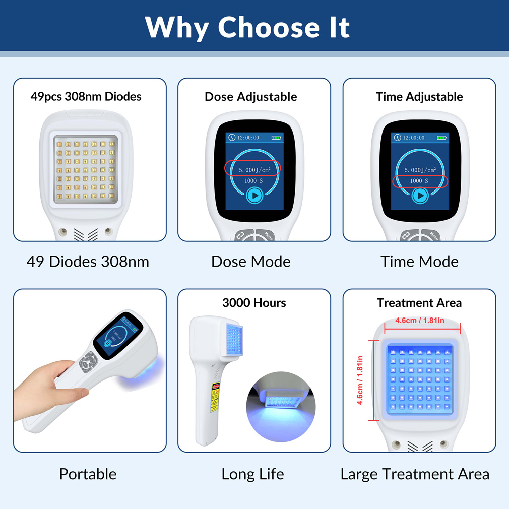 ボディ・フェイスケア UVB LIGHT THERAPY DEVICE UL-01 308nm ボディ・フェイスケア UVB LIGHT THERAPY DEVICE UL-01 308nm ボディ