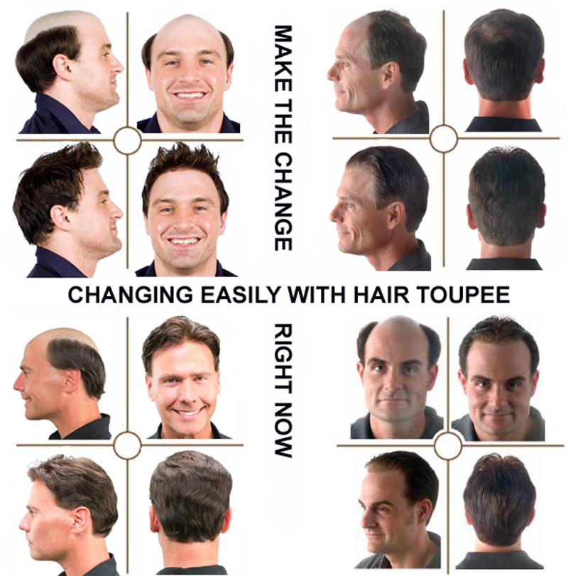 Nlw 2pcs Hairpieces For Men Toupee Hair Replacement Man Piece